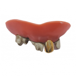 Dentier Dents Pourries